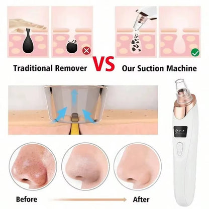 Electric Pore Cleaner & Blackhead Remover – Deep Cleansing Facial Vacuum Tool - Bare Radiance Skin and Beauty