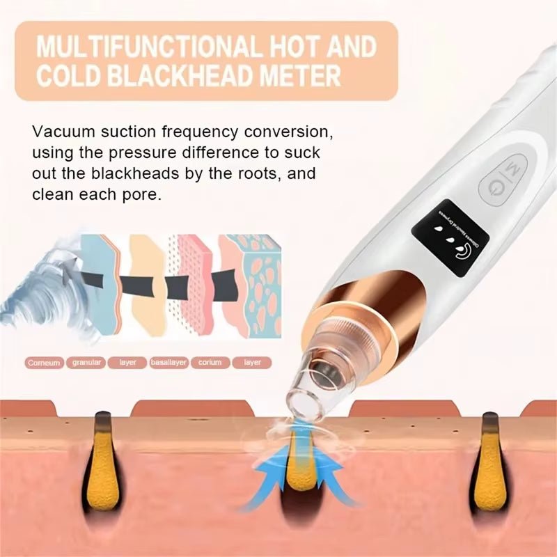 Electric Pore Cleaner & Blackhead Remover – Deep Cleansing Facial Vacuum Tool - Bare Radiance Skin and Beauty