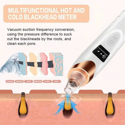 Electric Pore Cleaner & Blackhead Remover – Deep Cleansing Facial Vacuum Tool - Bare Radiance Skin and Beauty