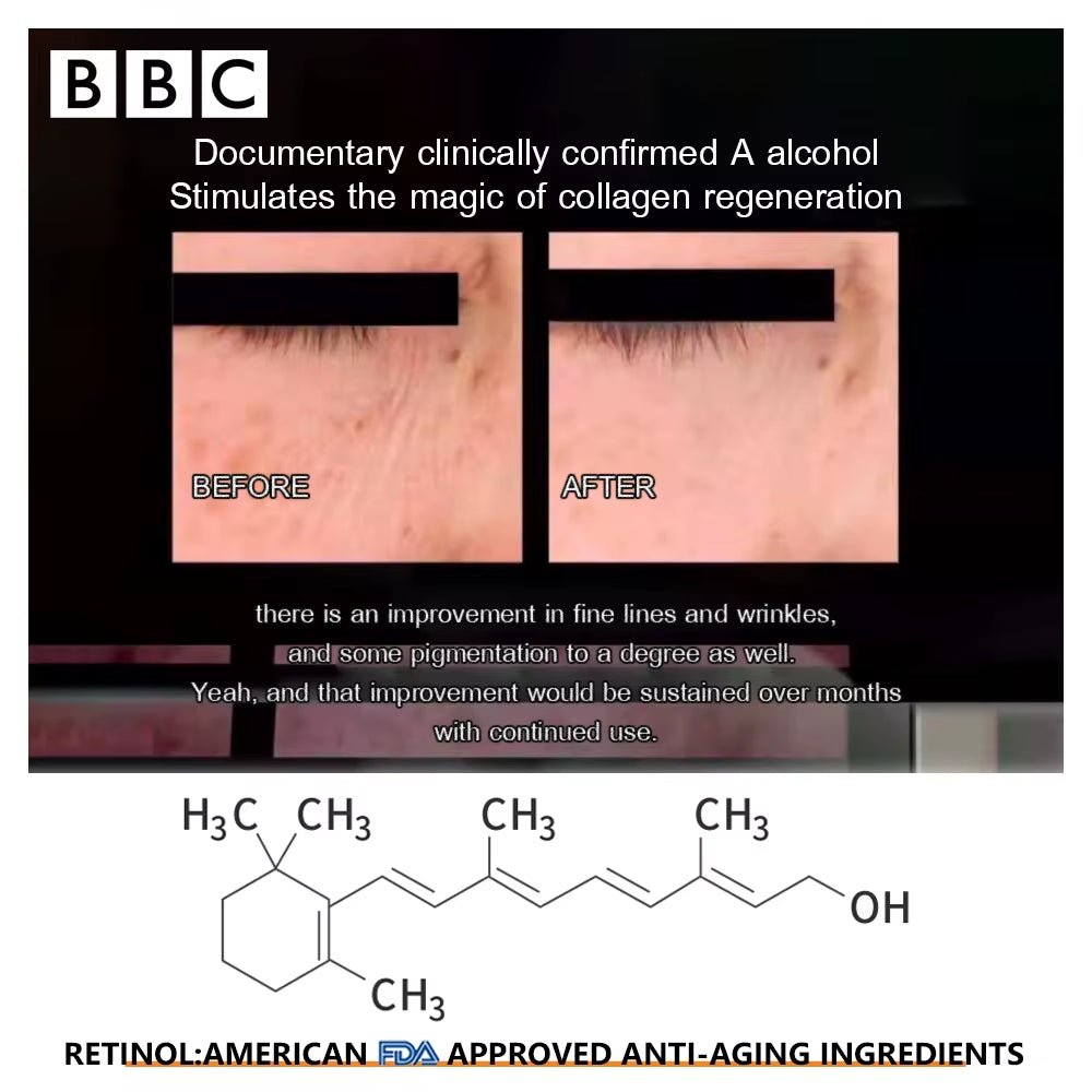 Retinol Face Cream – Moisturize, Brighten & Smooth - Bare Radiance Skin and Beauty