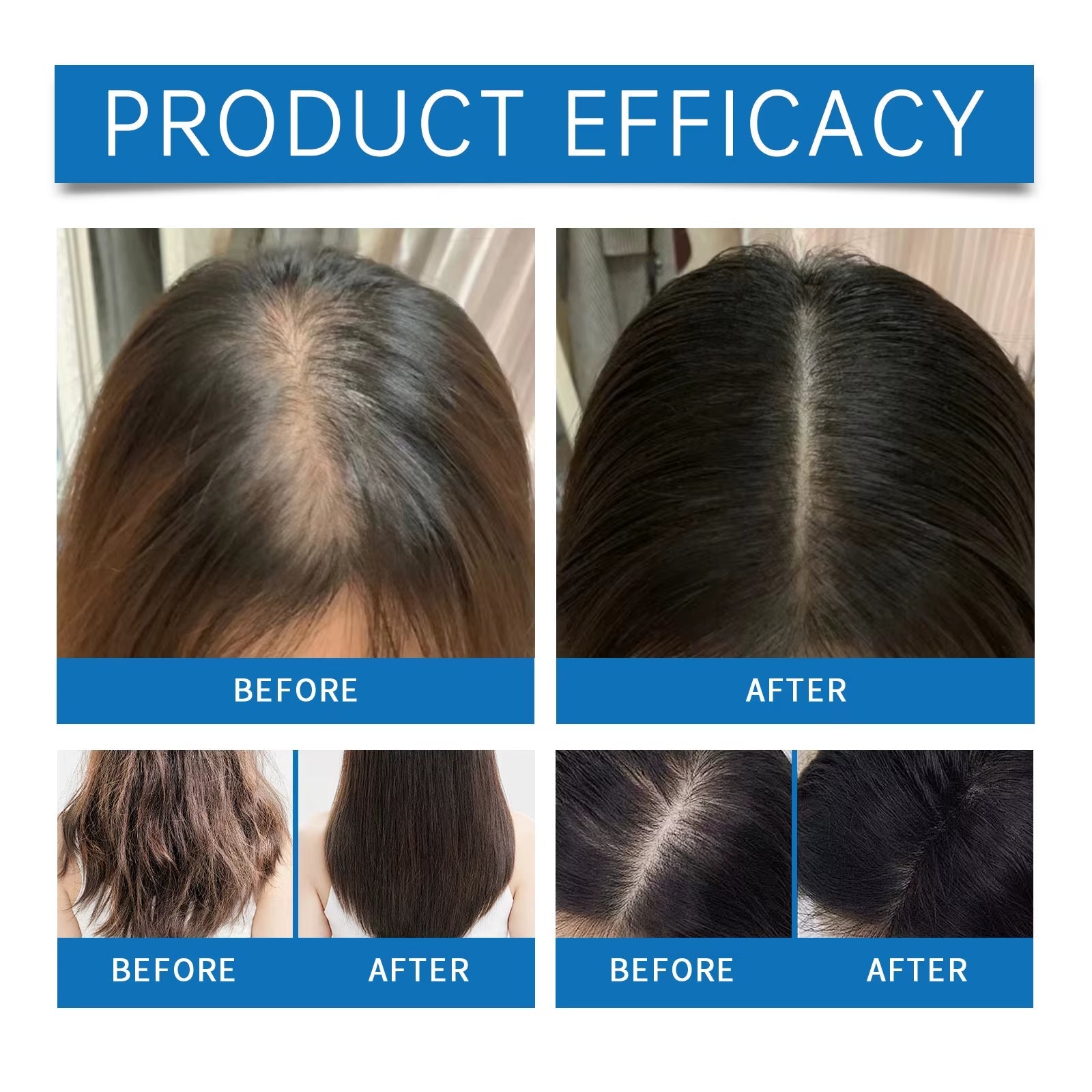 Rosemary Hair Serum - Bare Radiance Skin and Beauty