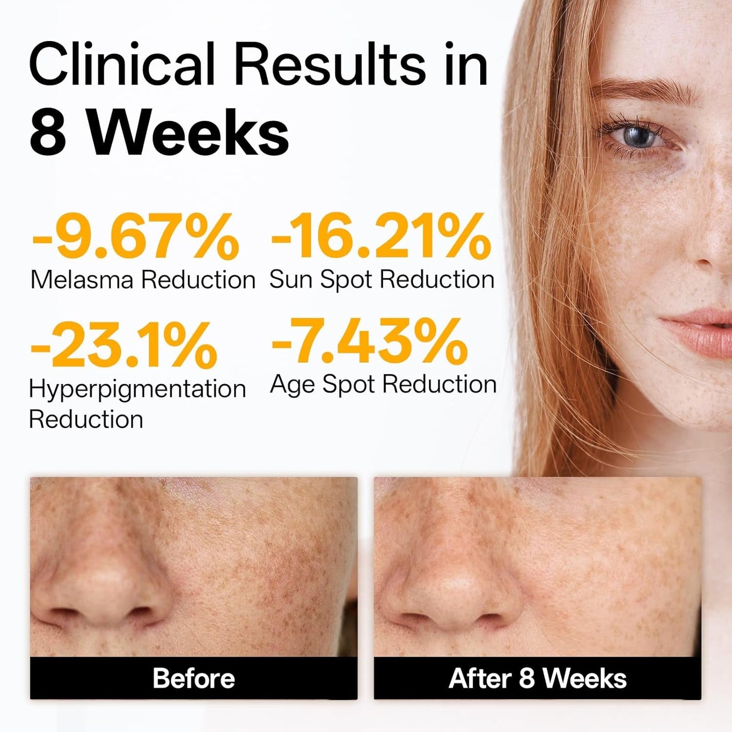 Vitamin C Brightening Facial Serum - Bare Radiance Skin and Beauty